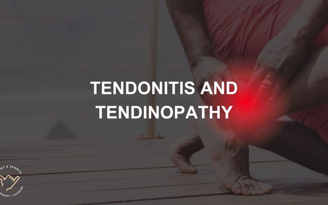 Tendonitis and tendinopathy - Surf and Sports Myotherapy