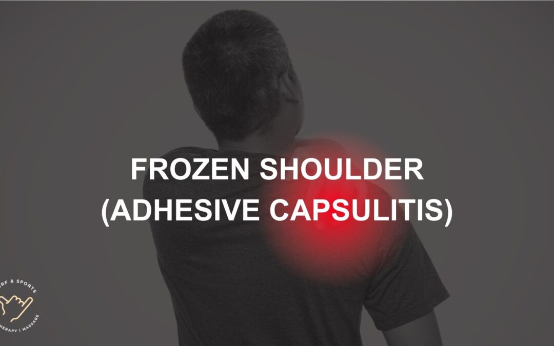 Frozen shoulder (adhesive capsulitis) - Surf and Sports Myotherapy