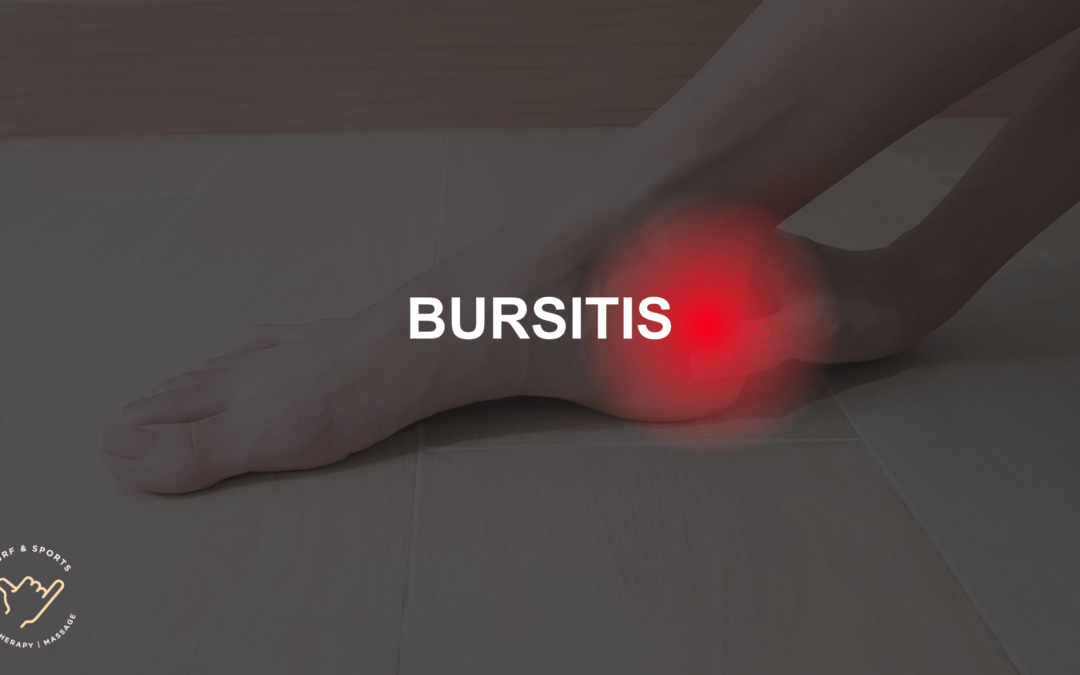 Bursitis