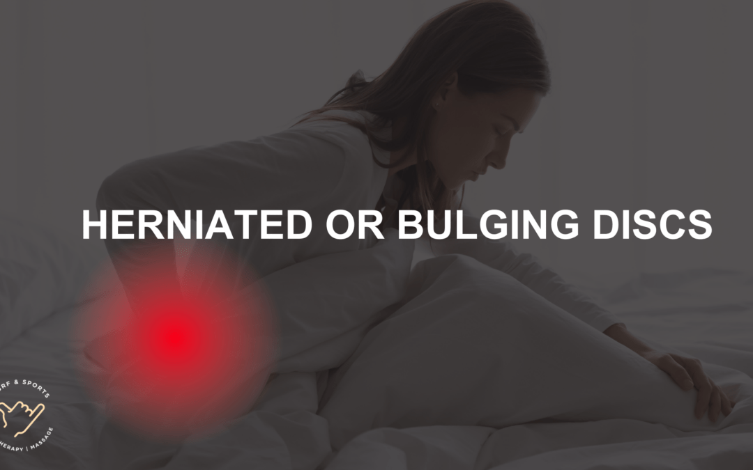 Herniated or bulging discs