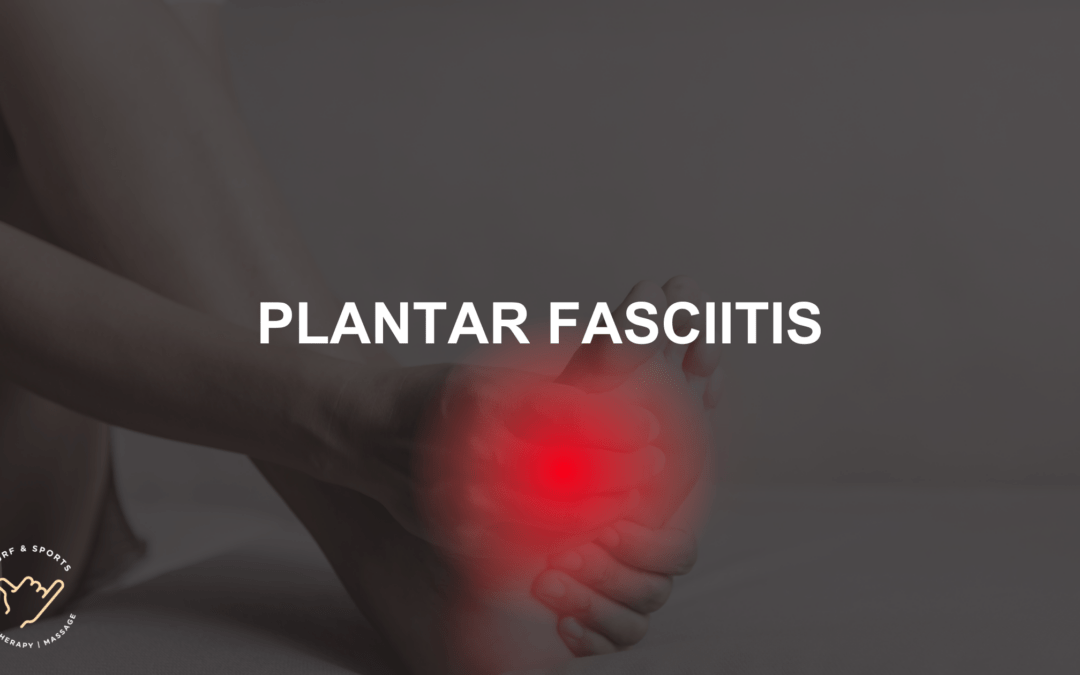 Plantar fasciitis