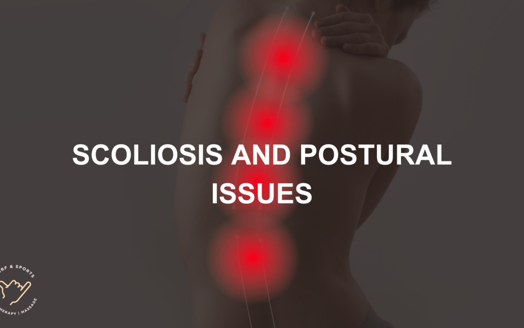 Scoliosis and postural issues